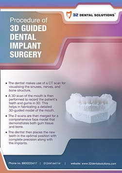 3D-guided-dental-implants