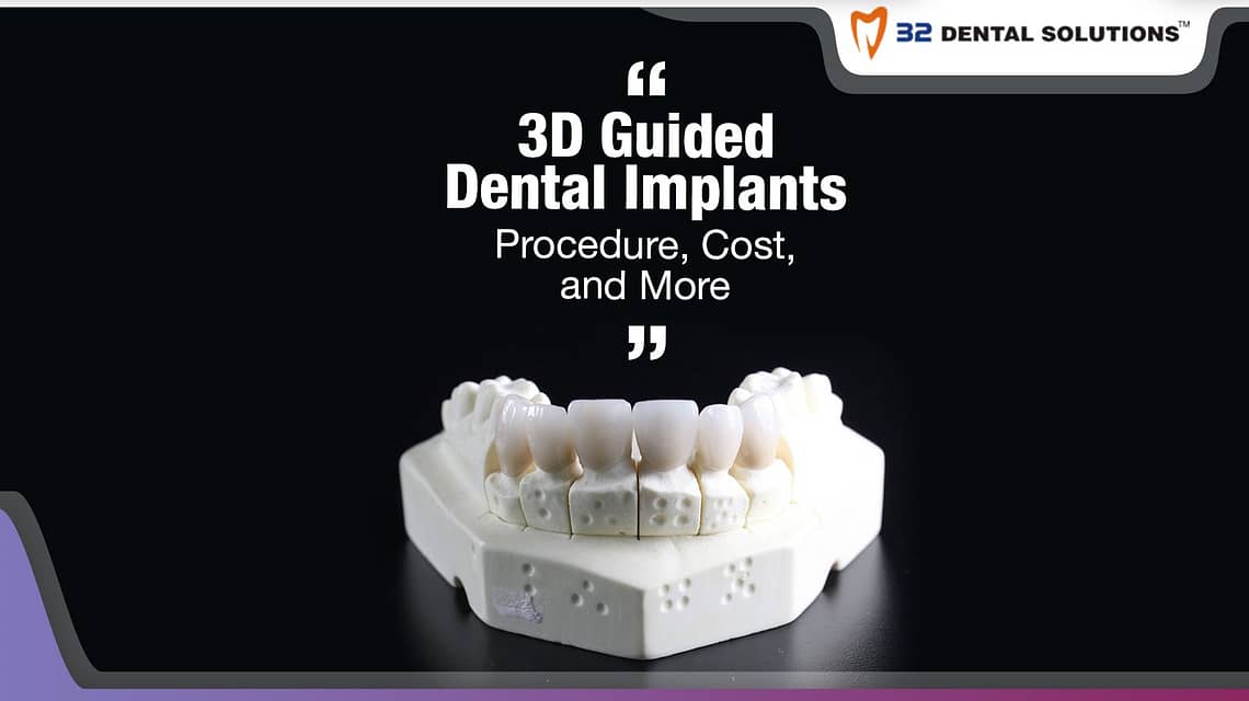3D-guided-dental-implants
