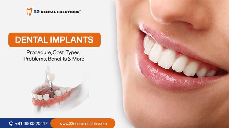 Best Dental Implants in Gurgaon